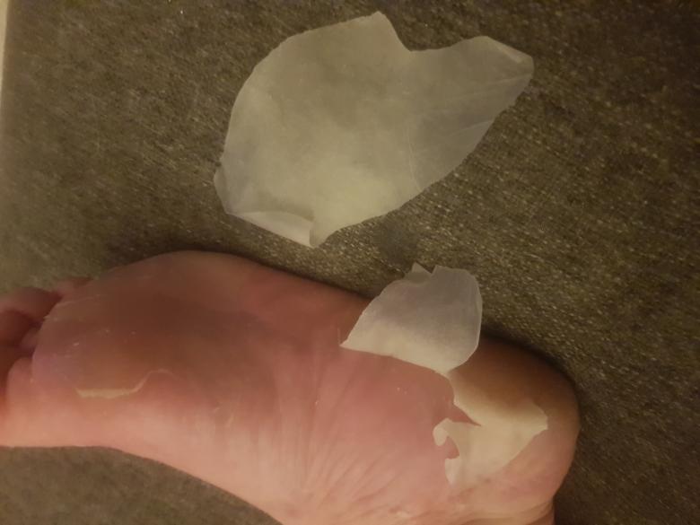 🦶🏻 Fußhaut,  Hornhaut 🦶🏻