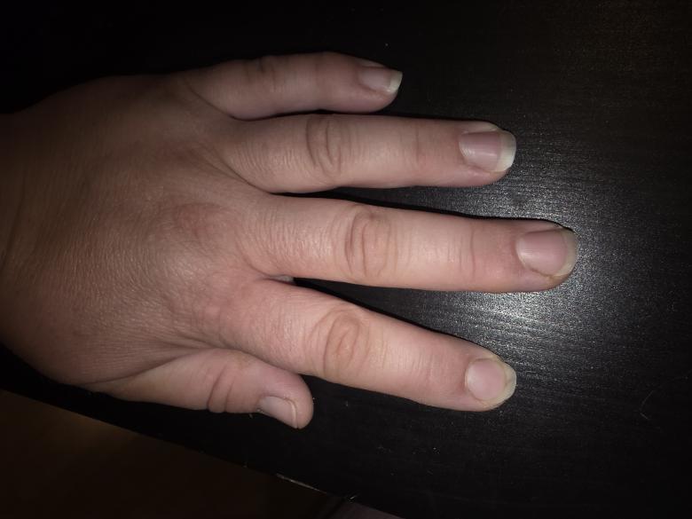 Nägel der Finger