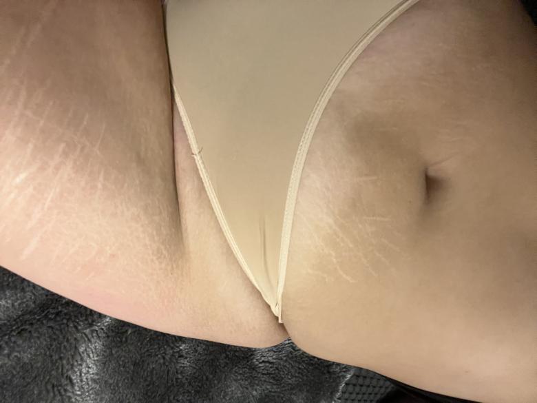 String
